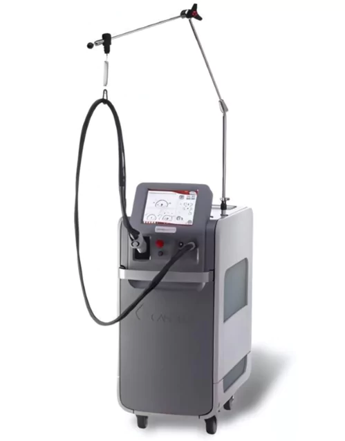 candela gentle YAG Laser hair reduction .webp