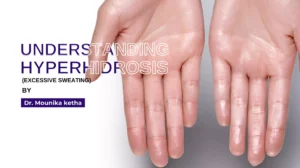 Read more about the article Understanding Hyperhidrosis: Managing Excessive Sweating and Its effects