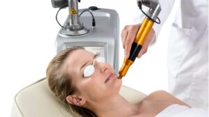Read more about the article Spectra XT Gold Toning