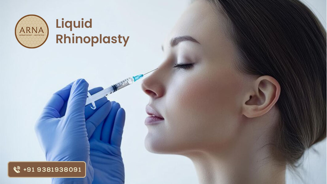 Sculpting the Perfect Nose Without Surgery: Liquid Rhinoplasty at Arna Clinic